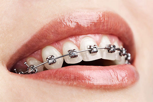 ortodonzia salerno dentista salerno antonio luongo